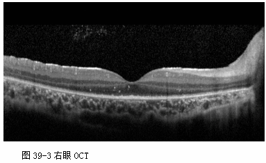 ZY016_211_4.gif